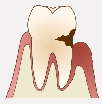 スクリーンショット_2-9-2025_173825_www.dental-sozai.com