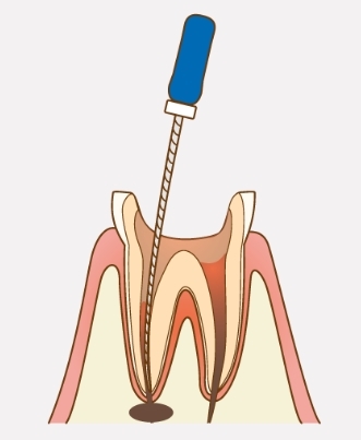 スクリーンショット_2-9-2025_173755_www.dental-sozai.com